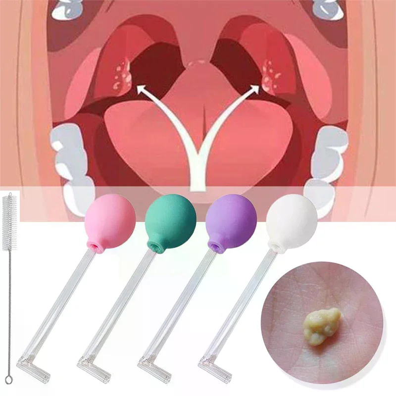 Stone Remover Tool Manual Styl - Ear Wax Remover review and price