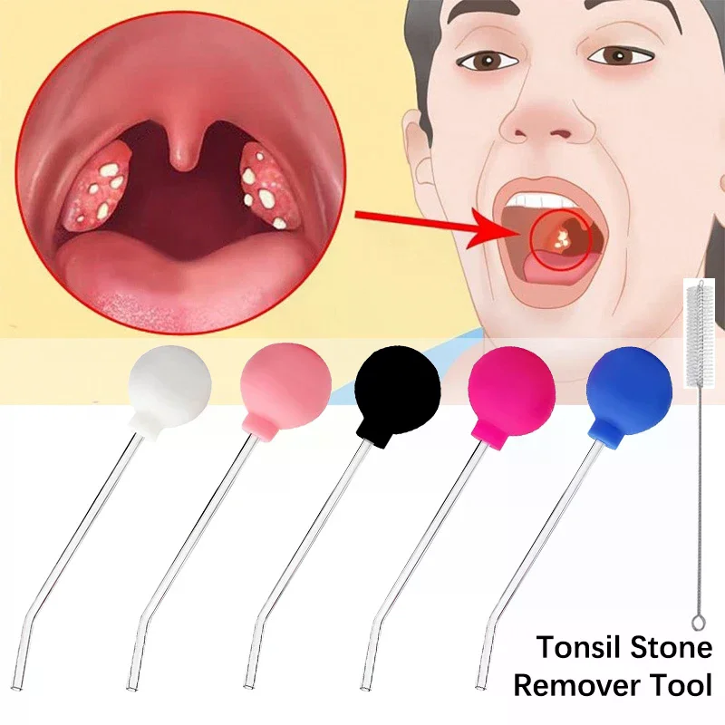 Stone Remover Tool Manual Styl - Ear Wax Remover review and price